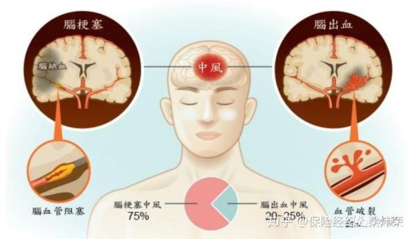 脑出血后还能买什么保险？（脑出血应该上哪个保险）