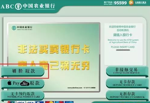 农行取号a和v和w的区别？（农业银行取号按哪个）